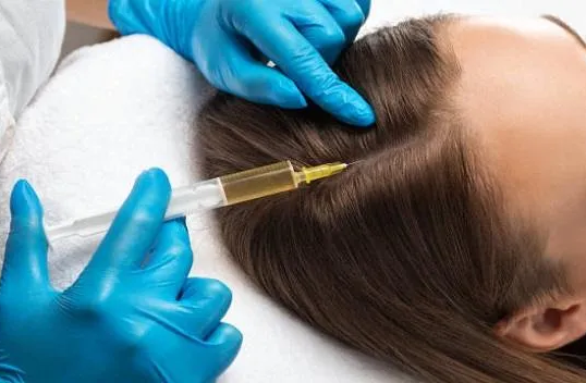 Hair Loss Treatment in Islamabad: A Complete Care Guide